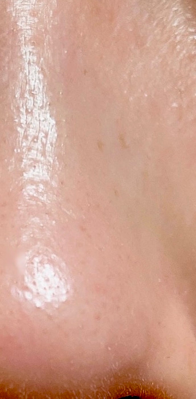 ゼロ1DAYエクソソームショット2000/MEDICUBE/美容液を使ったクチコミ(2枚目)