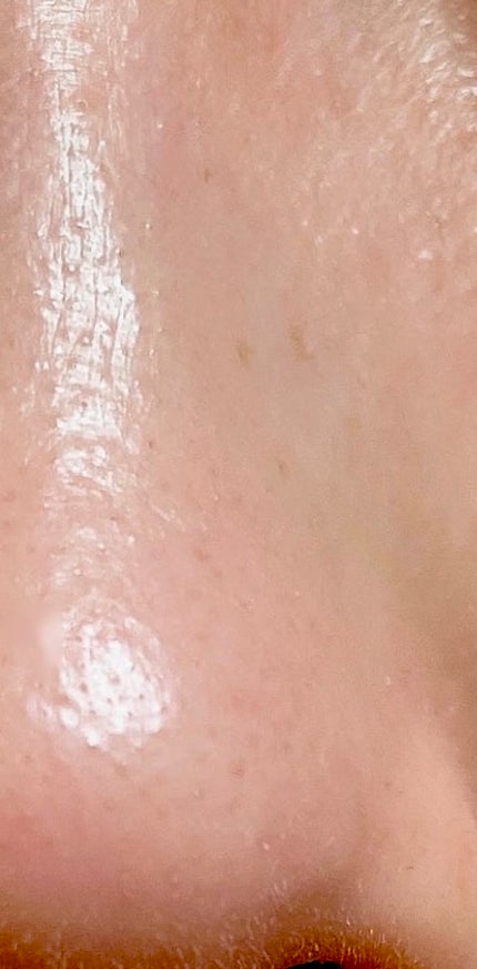 ゼロ1DAYエクソソームショット7500/MEDICUBE/美容液を使ったクチコミ(2枚目)