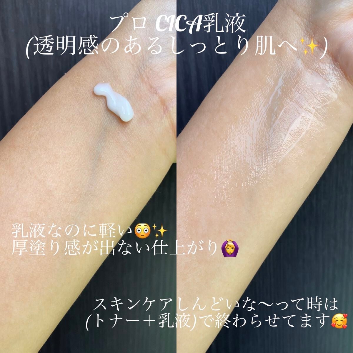 プロ シカ センテラ アジアティカ タイガー スキン/VT/化粧水を使ったクチコミ(5枚目)