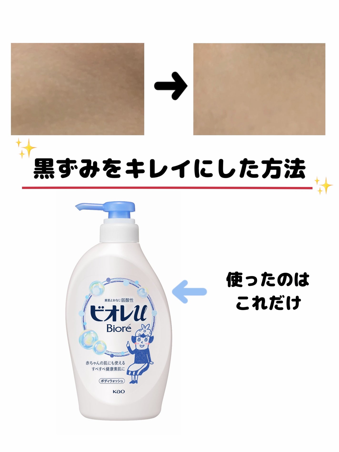 やさしいフレッシュフローラルの香り 微香性/ビオレu/ボディソープを使ったクチコミ(1枚目)