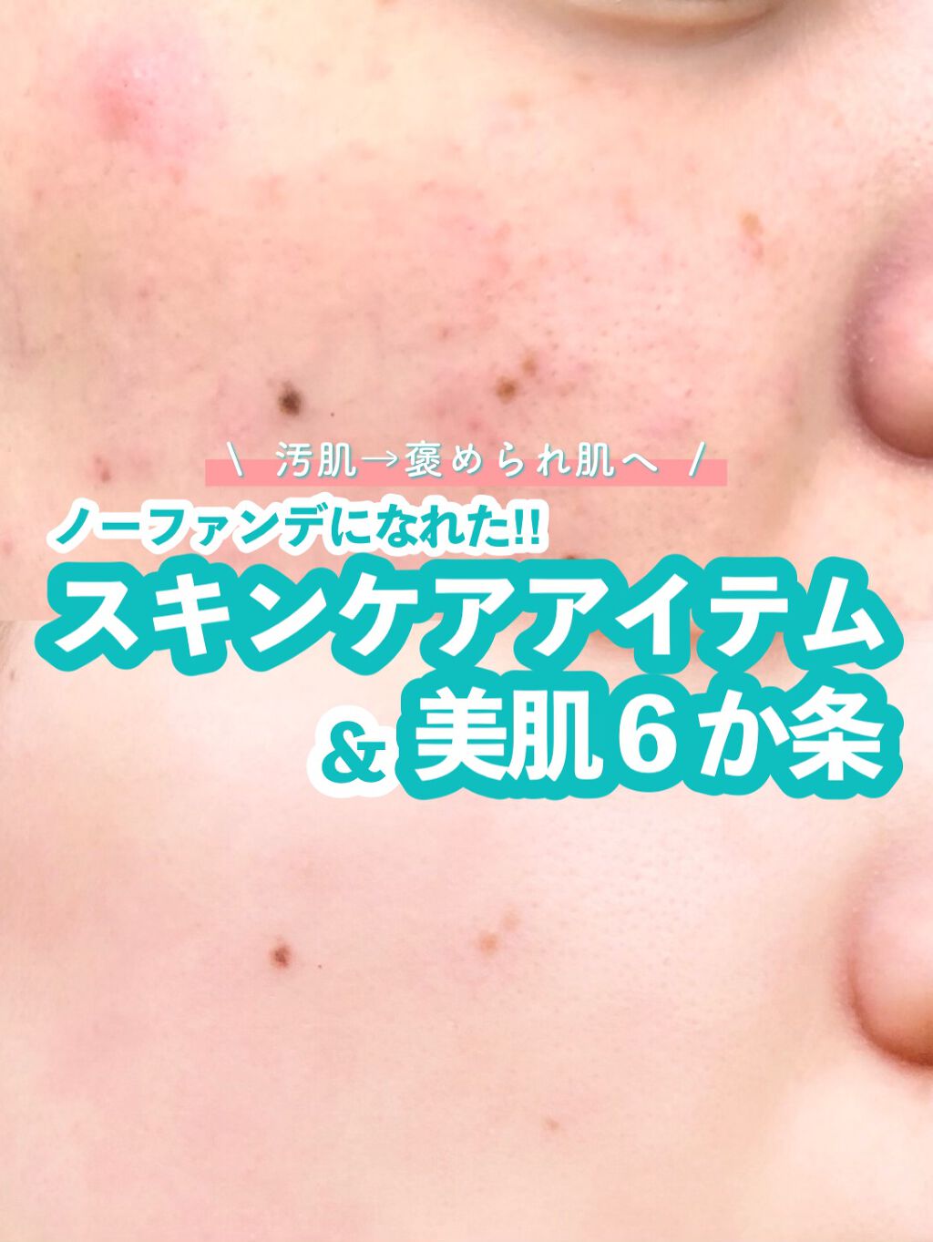 リンクル化粧水 Ｎ/なめらか本舗/化粧水を使ったクチコミ（1枚目）