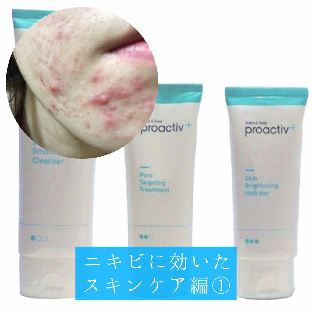 薬用3ステップセット30日サイズ/プロアクティブ/トライアルキットを使ったクチコミ(1枚目)