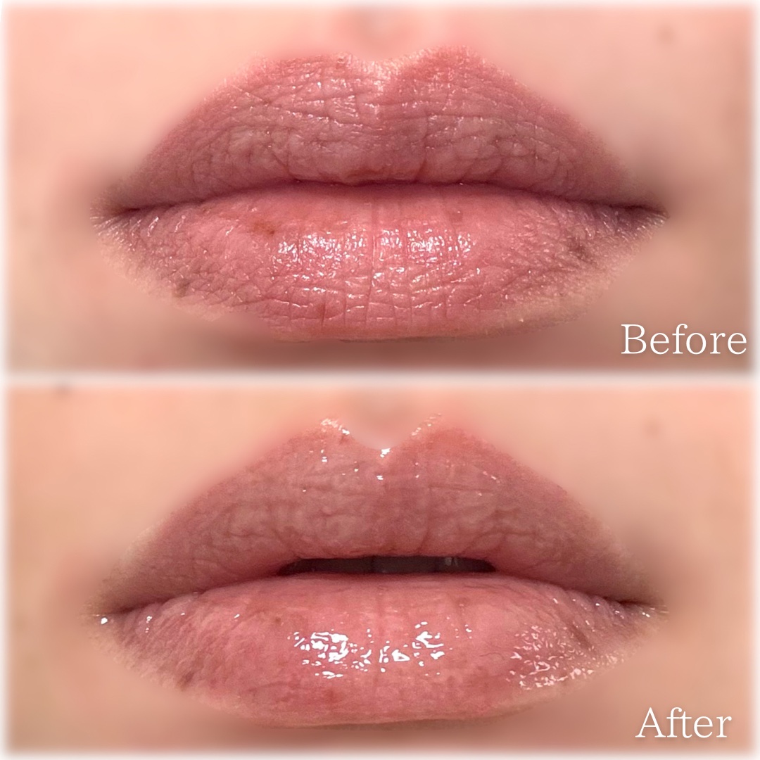 LIPS SHOT/MOTTO LAB./リップマスクを使ったクチコミ（3枚目）