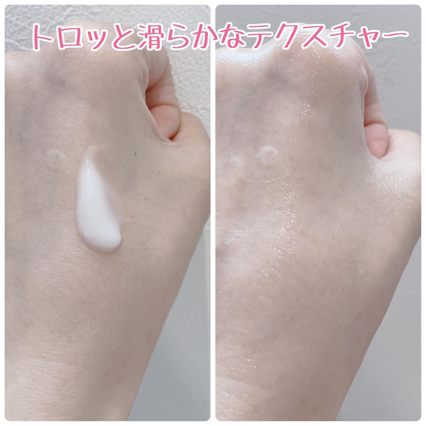 薬用アクアコラーゲンゲル スーパーセンシティブEX/ドクターシーラボⓇ/オールインワン化粧品を使ったクチコミ(7枚目)