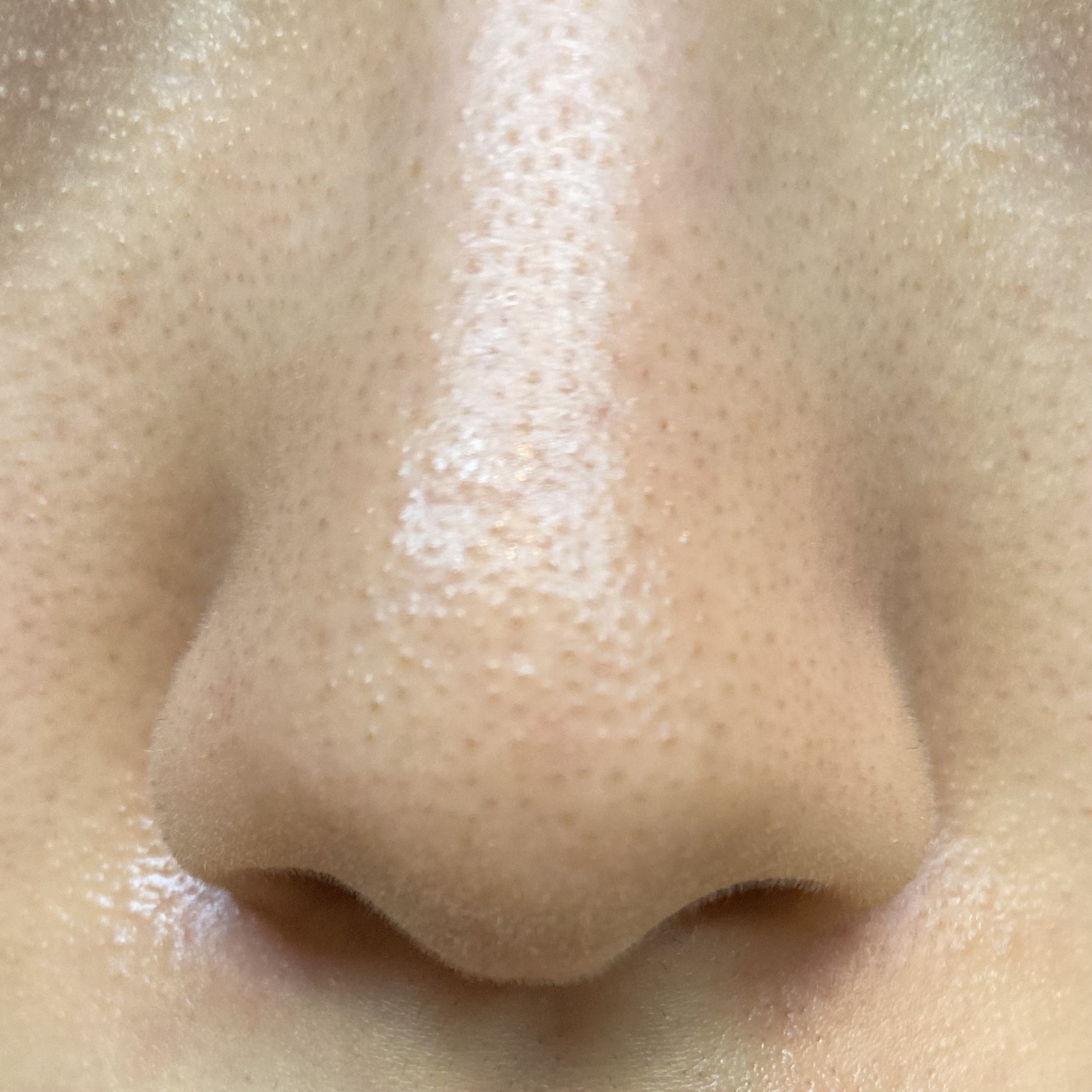 薬用しみ集中対策 プレミアム美容液/メラノCC/美容液を使ったクチコミ（2枚目）