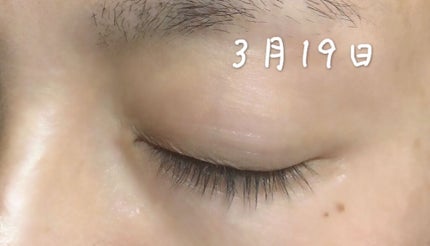 アヴァンセ ラッシュセラム EX(医薬部外品)/アヴァンセ/その他を使ったクチコミ(2枚目)