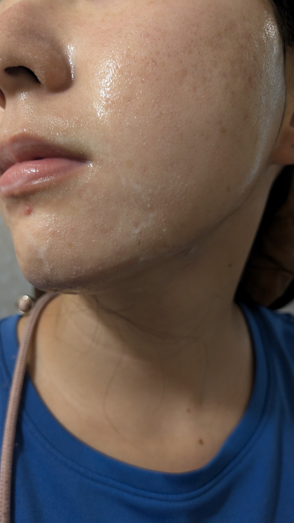 A2+NAG2ソリューション/The Ordinary/美容液を使ったクチコミ（2枚目）