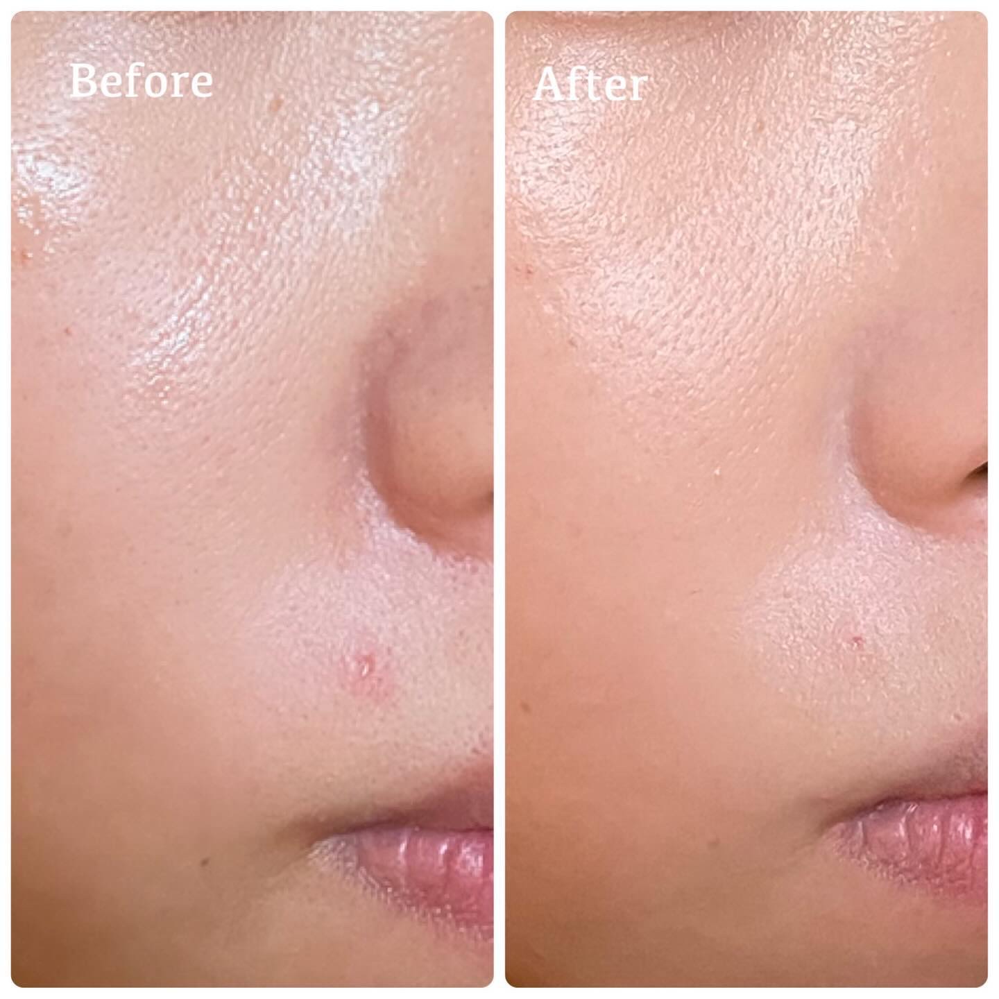 カバーリシャス アルティメット ホワイトクッション/BANILA CO/クッションファンデーションを使ったクチコミ（3枚目）