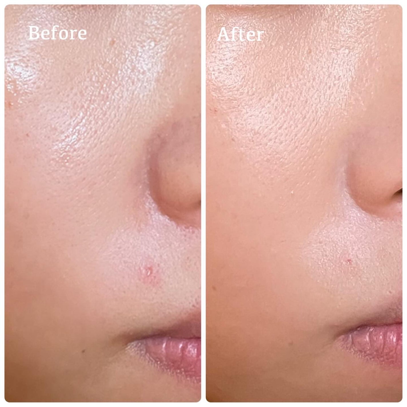 カバーリシャス アルティメット ホワイトクッション/BANILA CO/クッションファンデーションを使ったクチコミ(3枚目)