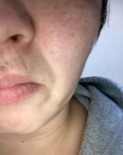 にゃんこ on LIPS 「BYAKURANW・Jクリーム試してみました。ヒアルロン酸配合..」(8枚目)