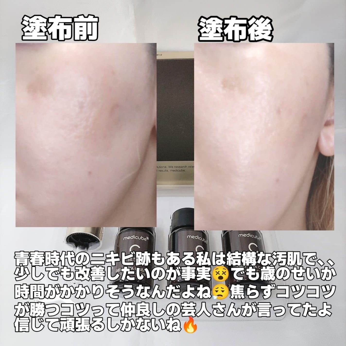 ディープビタCアンプル2.0/MEDICUBE/美容液を使ったクチコミ(7枚目)