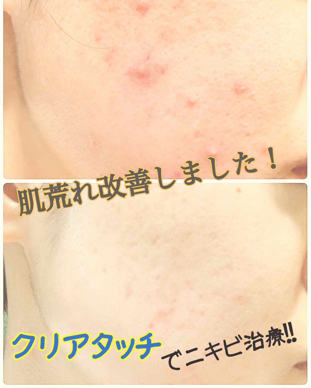 を使ったクチコミ（1枚目）