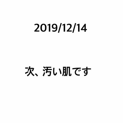 エリクシール ホワイト クリアエマルジョン C II/エリクシール/乳液を使ったクチコミ(1枚目)