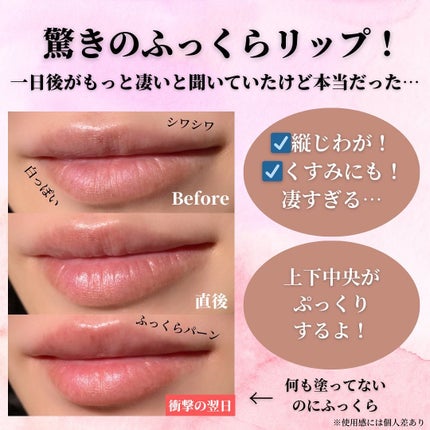 LIPS SHOT/MOTTO LAB./リップマスクを使ったクチコミ(3枚目)