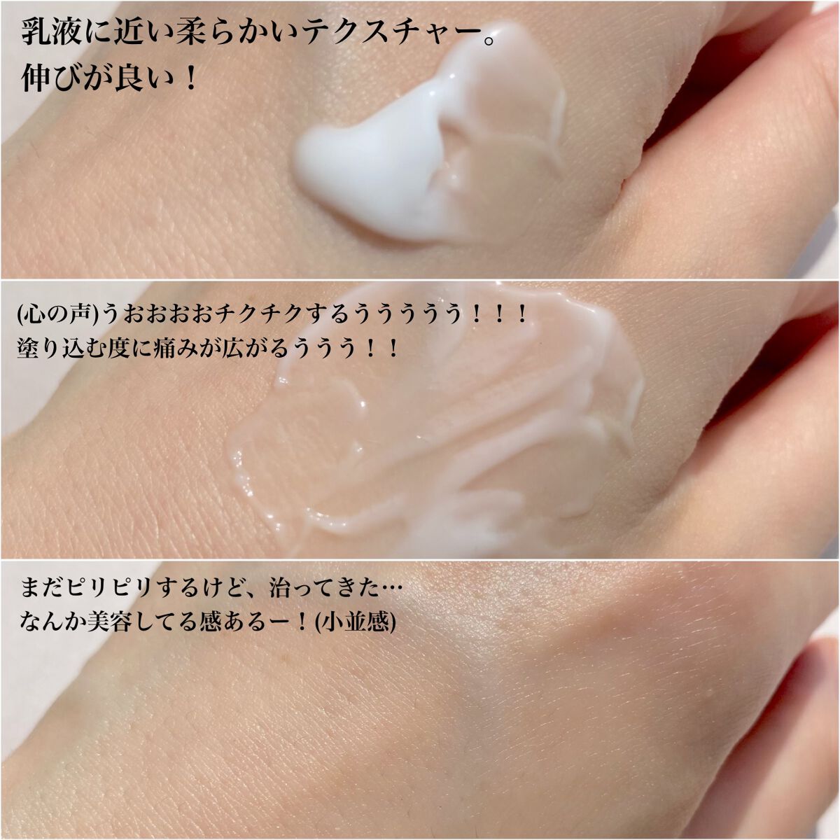 メディリフト ニードルリフトクリーム/YA-MAN TOKYO JAPAN/フェイスクリームを使ったクチコミ（3枚目）