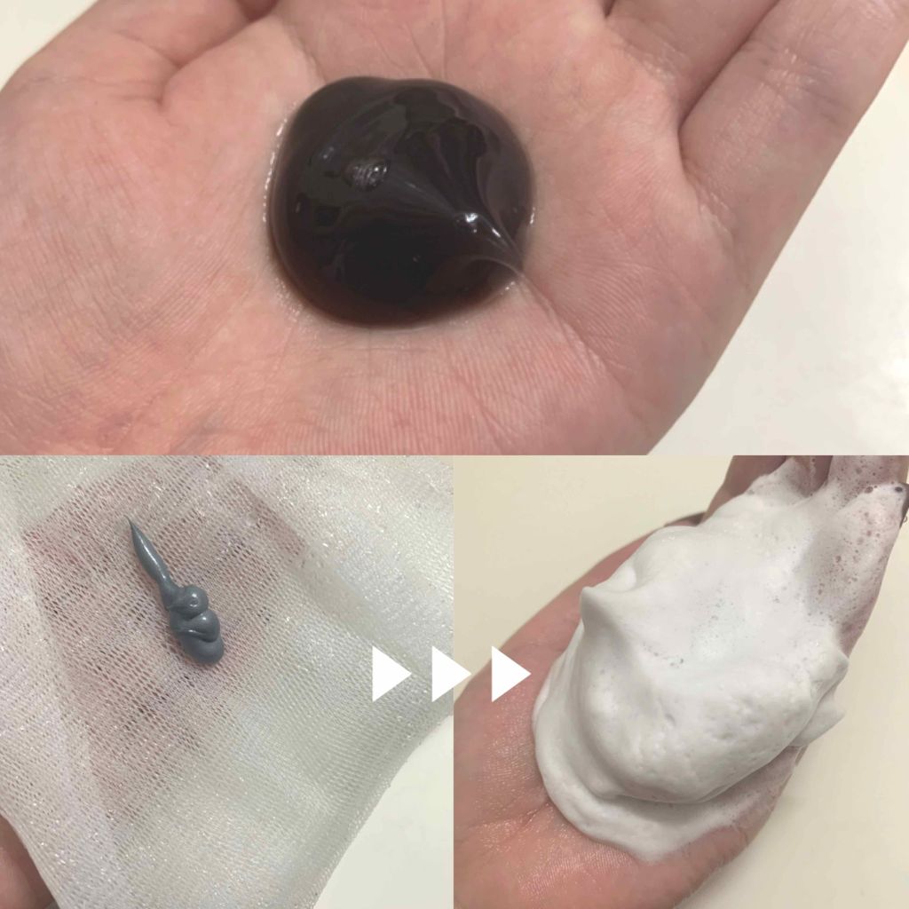 オルフェス　ブラックシリーズ　初回スターターセット/ALFACE+/スキンケアキットを使ったクチコミ（2枚目）