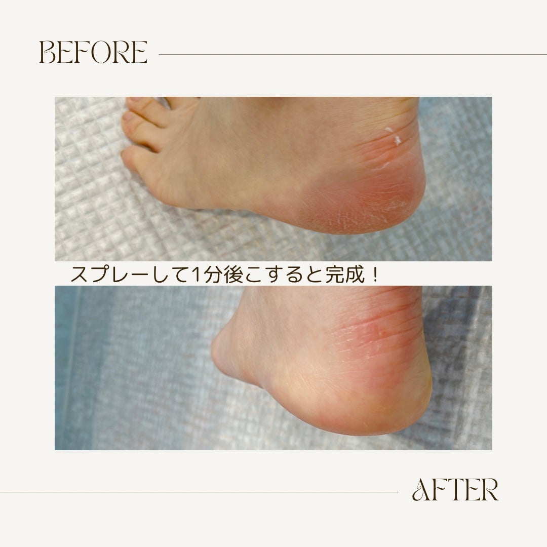 フットケアセット/BAREN/その他キットセットを使ったクチコミ(2枚目)