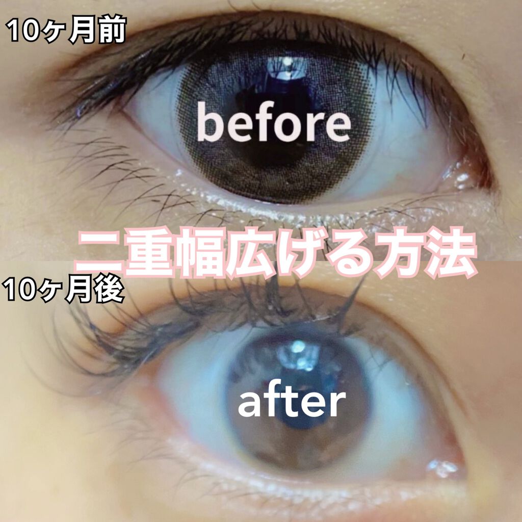 のびーるアイテープ（絆創膏タイプ、レギュラー）/DAISO/二重まぶた用アイテムを使ったクチコミ（1枚目）