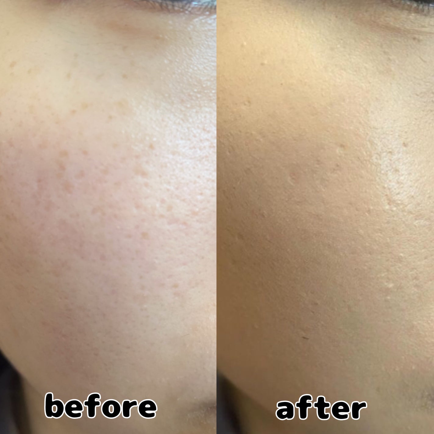 rily on LIPS 「今回は私が今まで使ったファンデーションの中で1番良かったと思う..」(4枚目)