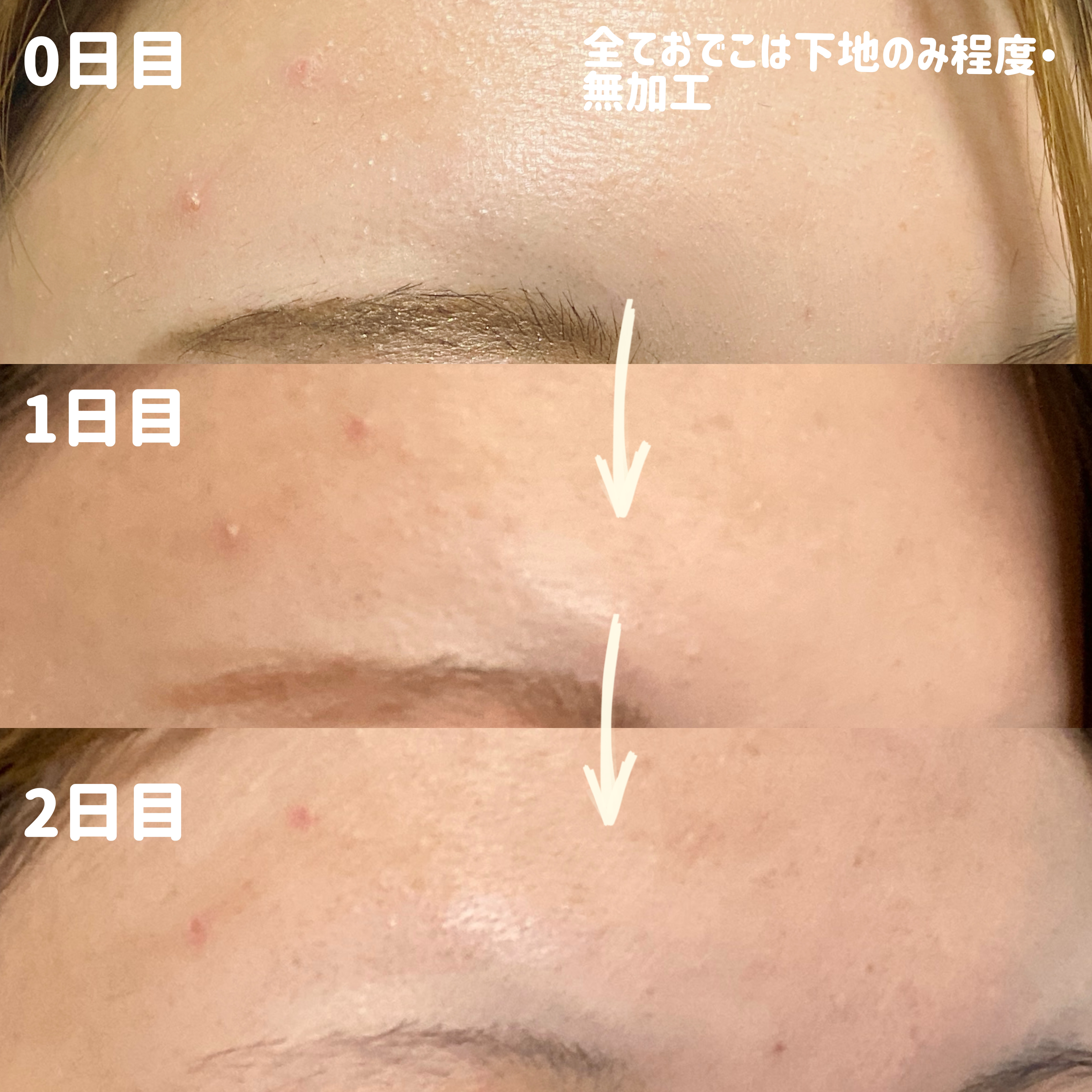 AZアゼライン酸10セラム/コスデバハ/美容液を使ったクチコミ（3枚目）