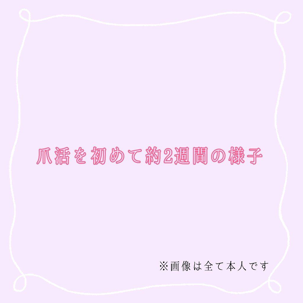 ハンドベール 乾燥 バリアクリーム/メンソレータム/ハンドクリームを使ったクチコミ（1枚目）