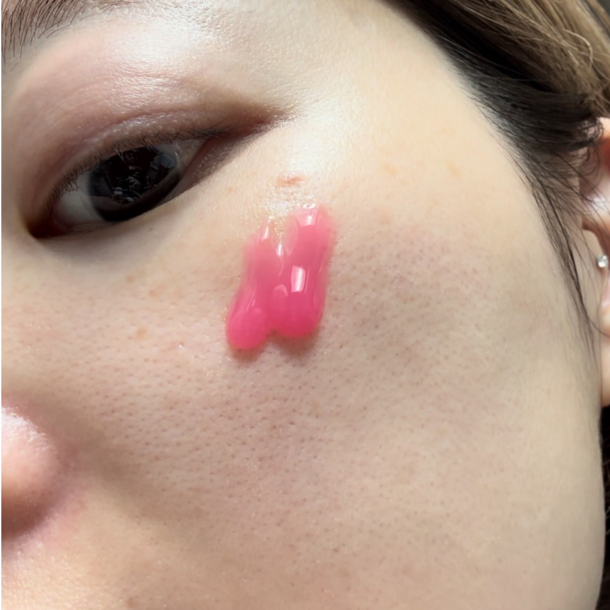 セメンリトシアノ ピンクスピキュールセラム/Dr.Melaxin/美容液を使ったクチコミ（2枚目）