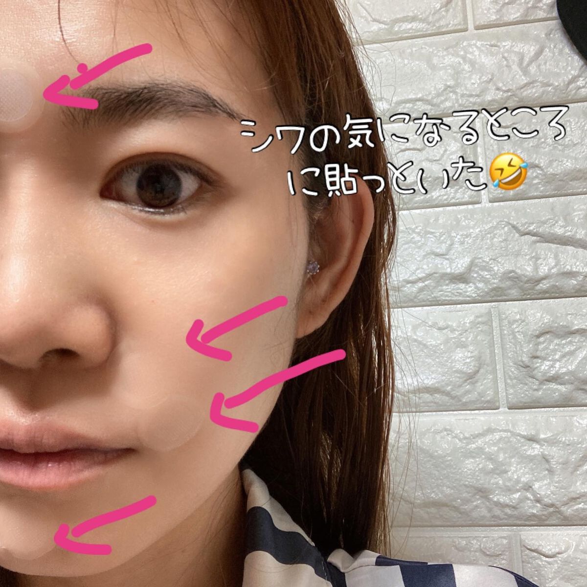 マイクロニードル ポイントパッチ/Lassovie/その他スキンケアを使ったクチコミ（3枚目）