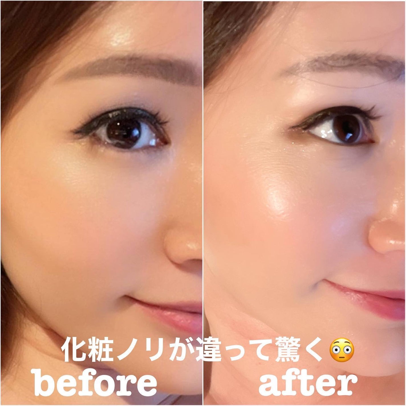 エージプロテオム/エステダム/美容液を使ったクチコミ(3枚目)