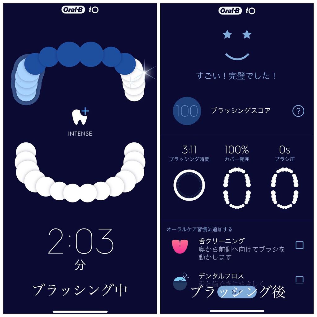 ブラウンオーラルB 電動歯ブラシ/ブラウン/電動歯ブラシを使ったクチコミ（2枚目）