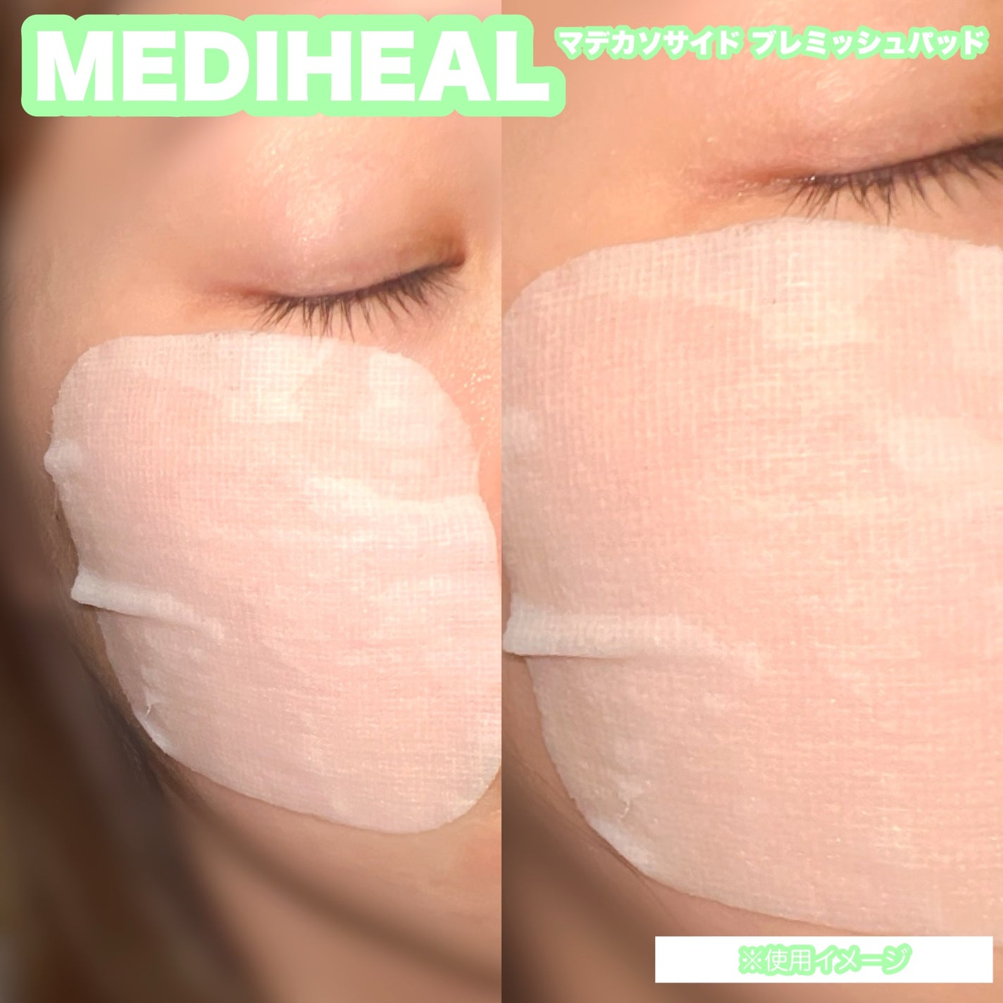 マデカソサイド ブレミッシュパッド/MEDIHEAL/トナーパッドを使ったクチコミ(4枚目)