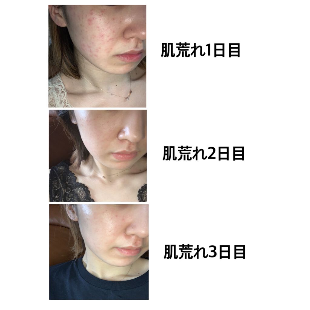 ドゥース ローション Ⅱ/BENEFIQUE/化粧水を使ったクチコミ(2枚目)