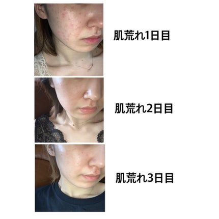 ドゥース ローション Ⅱ 200ml/BENEFIQUE/化粧水の画像