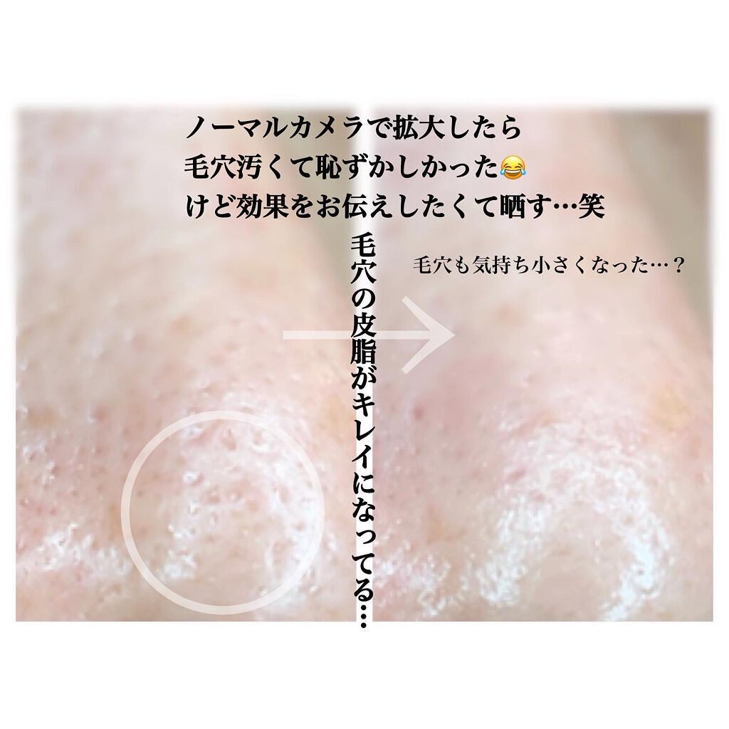 ノーモアブラックヘッド(ノーズピーリング)/One-day's you/スクラブ・ゴマージュを使ったクチコミ(7枚目)