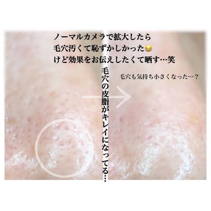 ノーモアブラックヘッド(ノーズピーリング)/One-day's you/スクラブ・ゴマージュを使ったクチコミ(7枚目)