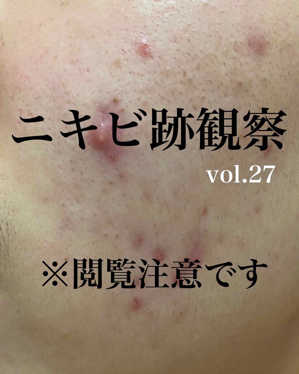 敏感肌用薬用美白美容液/無印良品/美容液を使ったクチコミ（1枚目）