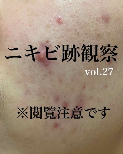 敏感肌用薬用美白美容液/無印良品/美容液を使ったクチコミ(1枚目)
