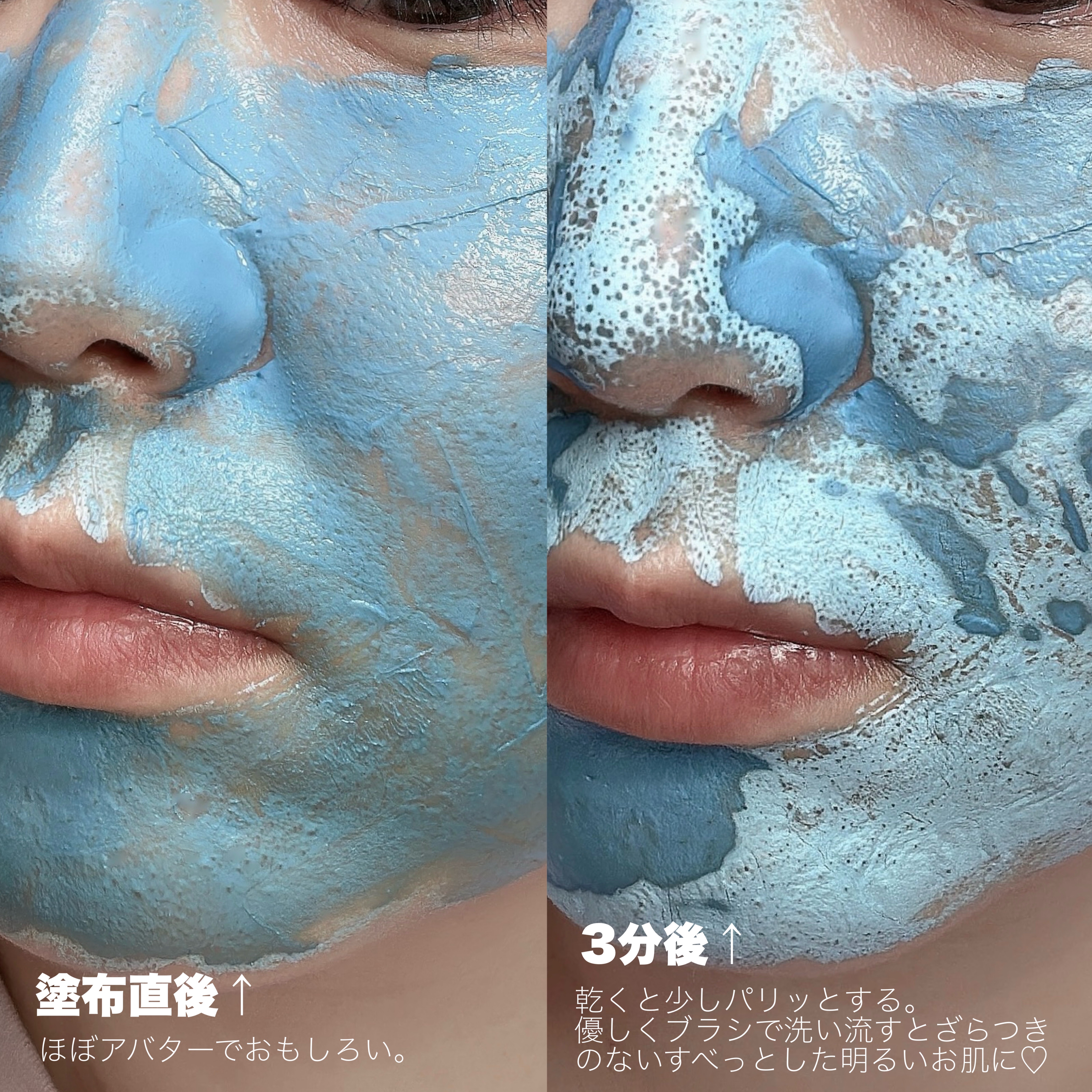 ゼロ毛穴クレイパック｜MEDICUBE他、1商品を使った口コミ