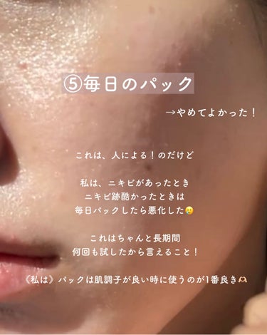 yuyu🐶肌荒れ体質の正直レビュー on LIPS 「【ニキビ跡ケア🔥やめてよかった6つのコト】✼••┈┈••✼••..」（6枚目）