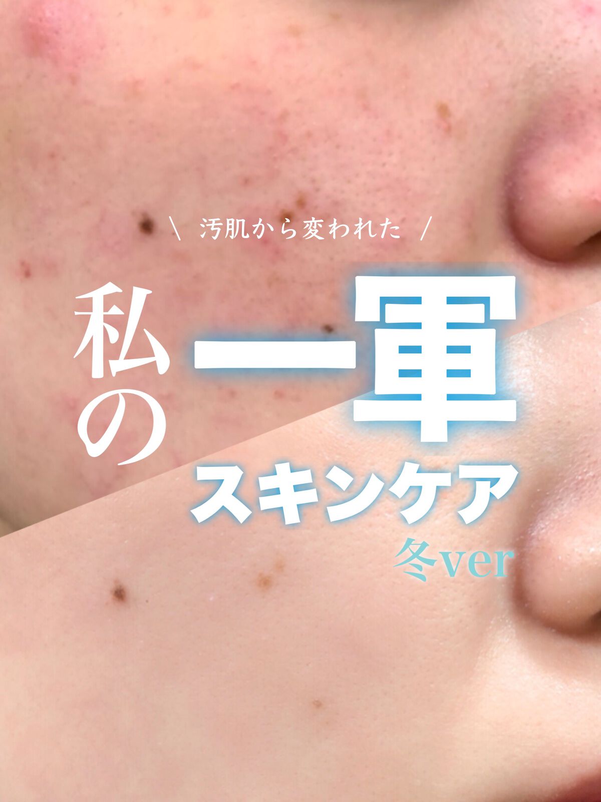 薬用エマルジョン/IHADA/乳液を使ったクチコミ(1枚目)