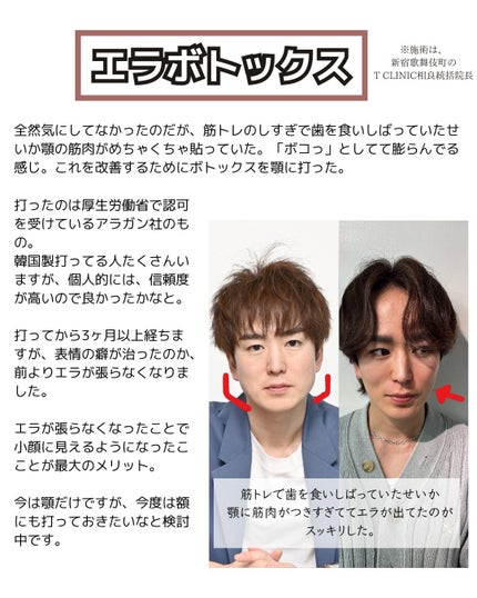 ヒロキ|40歳の美容家 ヘアケア スキンケア on LIPS 「マジで老けたくないのでスキンケア、食事など色々と美容やってきま..」(5枚目)