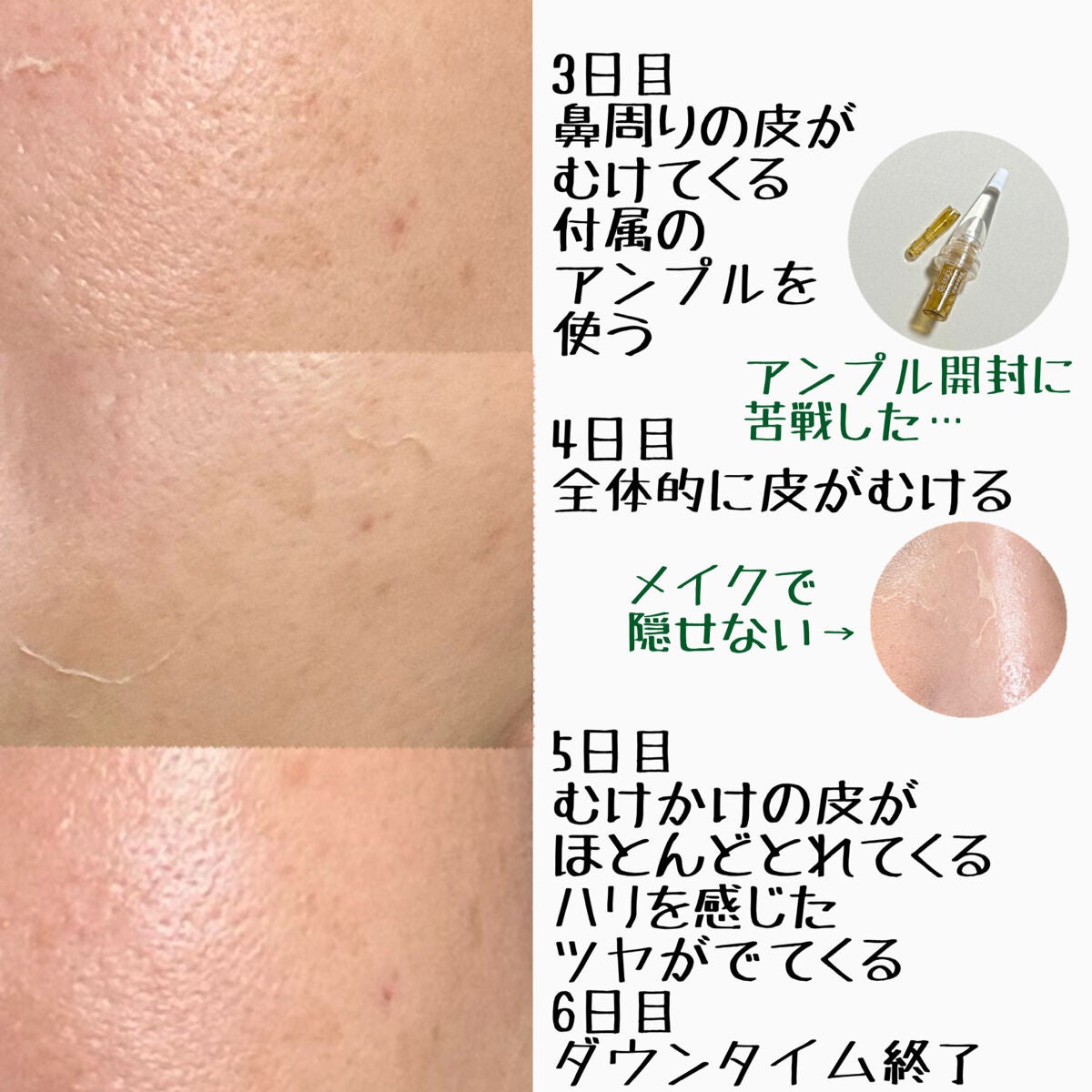 ダーマスキンピーリング/BQCELL/その他キットセットを使ったクチコミ(3枚目)