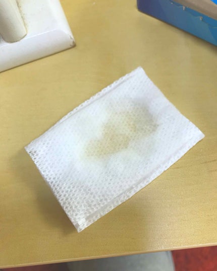 ネイチャーコンク 薬用クリアローション/ネイチャーコンク/拭き取り化粧水を使ったクチコミ(2枚目)