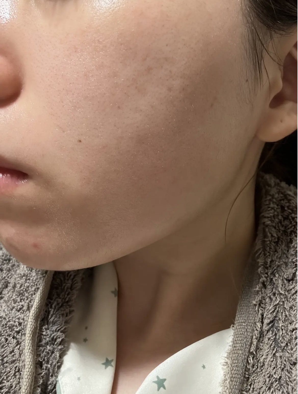  ビタプル リペア エッセンスローション/VITAPURU/化粧水を使ったクチコミ（3枚目）