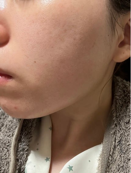 ビタプル リペアアクアリージェルクリーム/VITAPURU/フェイスクリームを使ったクチコミ(3枚目)