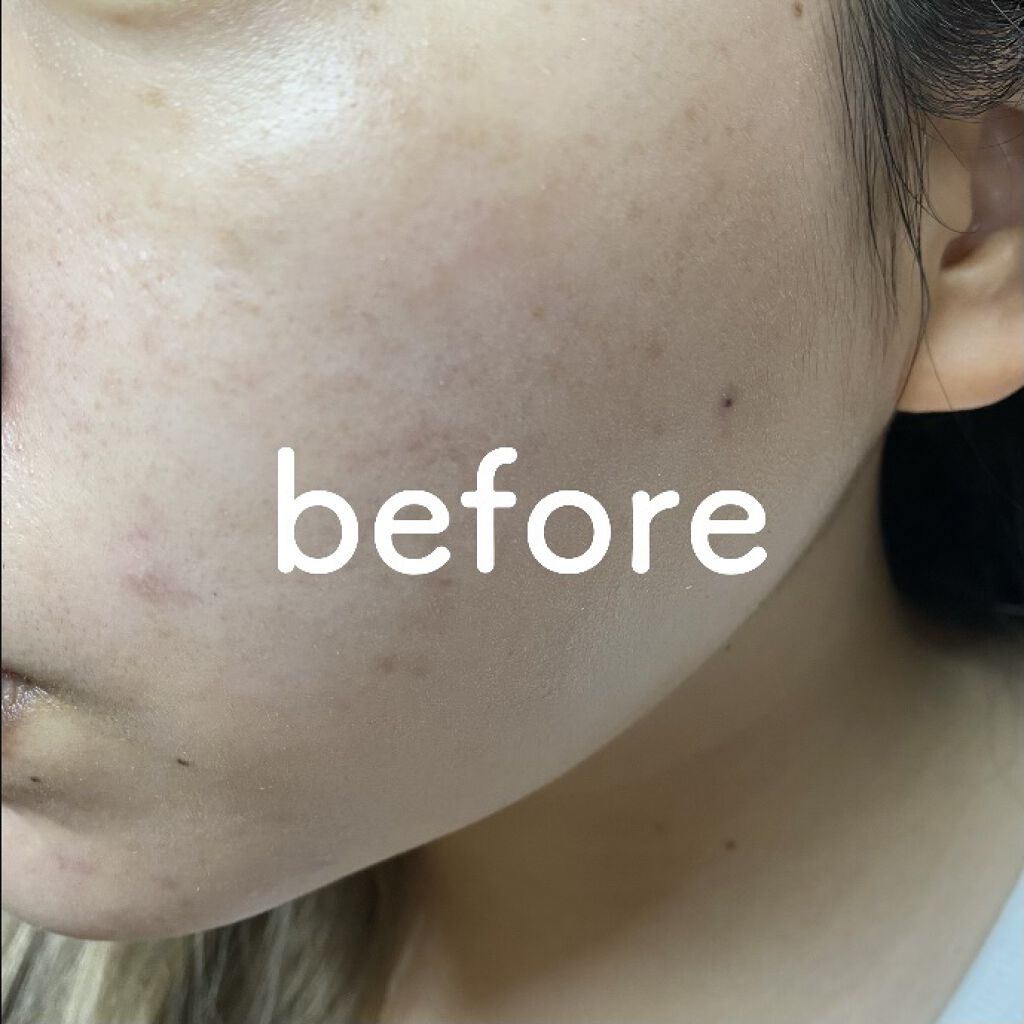 フィットミー リキッドファンデーション R/MAYBELLINE NEW YORK/リキッドファンデーションを使ったクチコミ（2枚目）