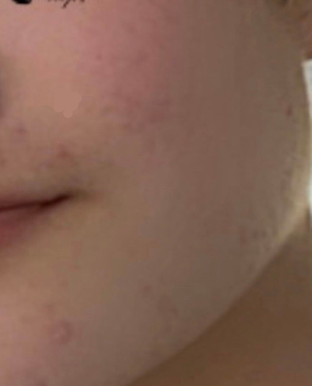 hinari on LIPS ãðã²ãšã€åã®æçš¿ã§ã®å¹æã«ã€ããŠã§ãâºïžðããããã²ã©ãã£ãæ..ãïŒ3æç®ïŒ