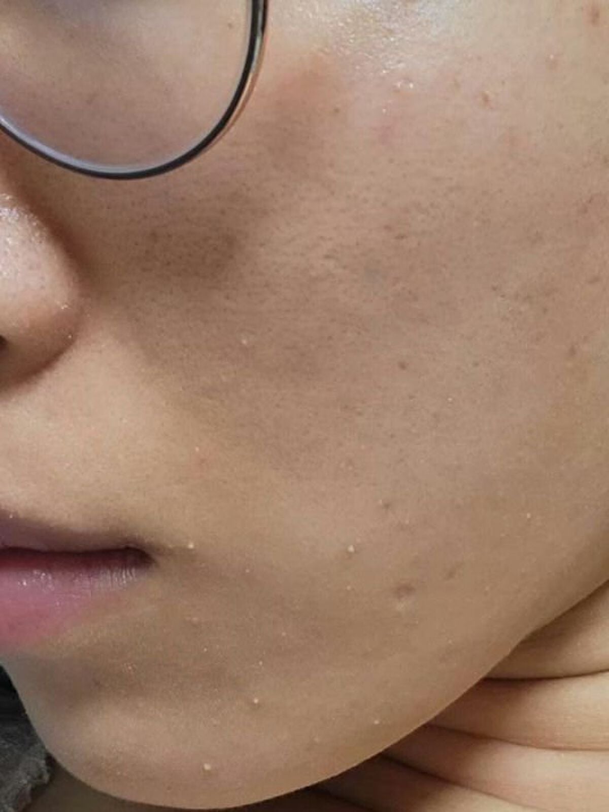 レチノールA 1% アドバンスドリバイタリゼーションクリーム/Life-flo/フェイスクリームを使ったクチコミ(4枚目)