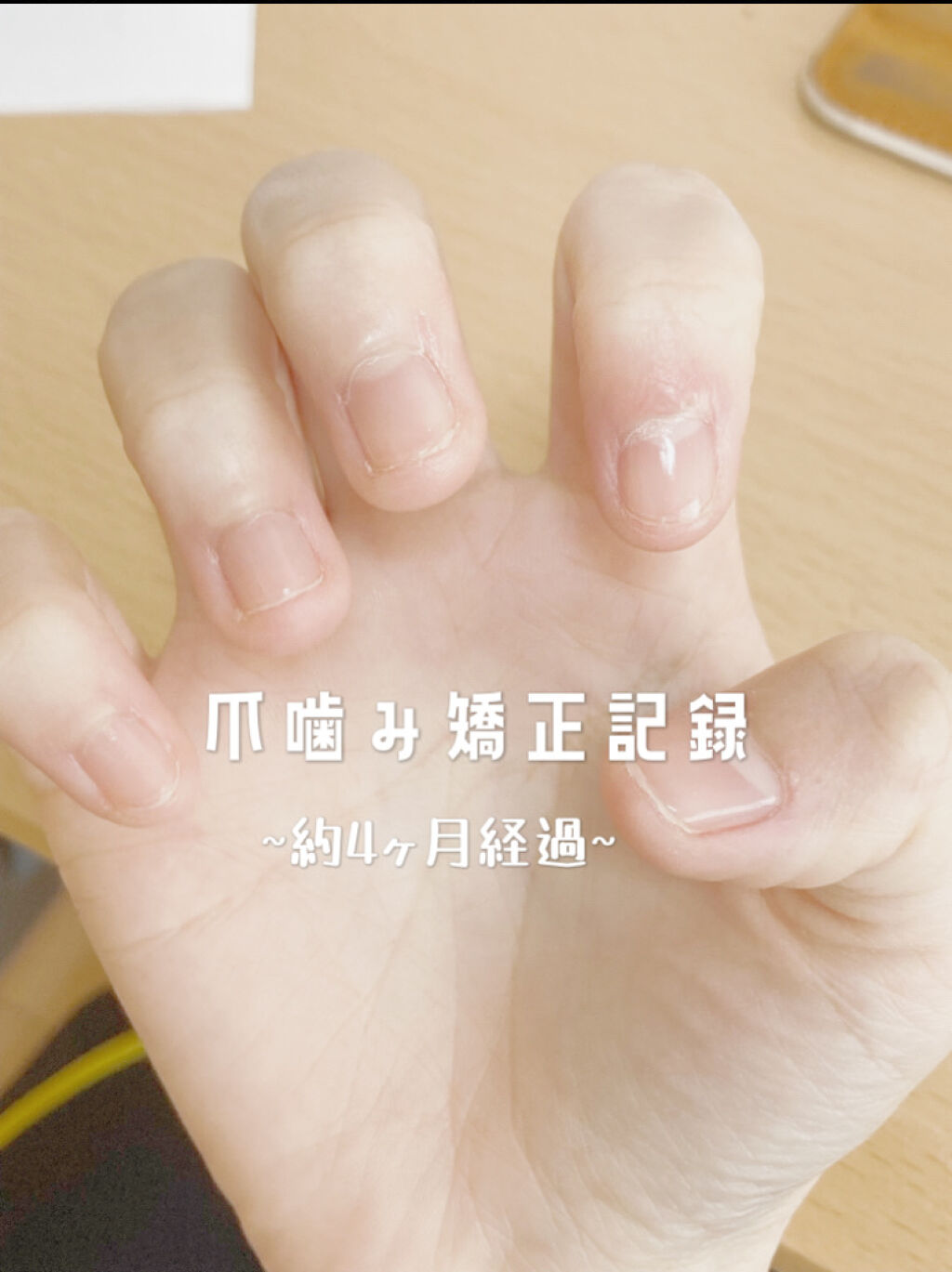 アロマキューティクルオイル/D-UP/ネイルオイル・トリートメントを使ったクチコミ（1枚目）