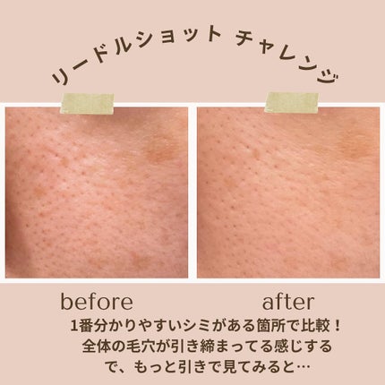 CICA デイリースージングマスク/VT/シートマスク・パックを使ったクチコミ(2枚目)