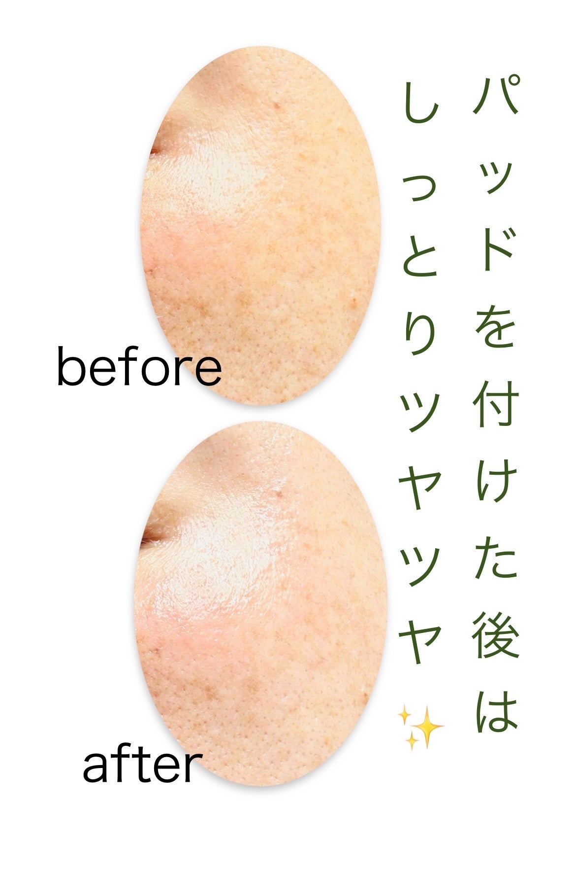 ライストナーパッド/I'm from/トナーパッドを使ったクチコミ(6枚目)